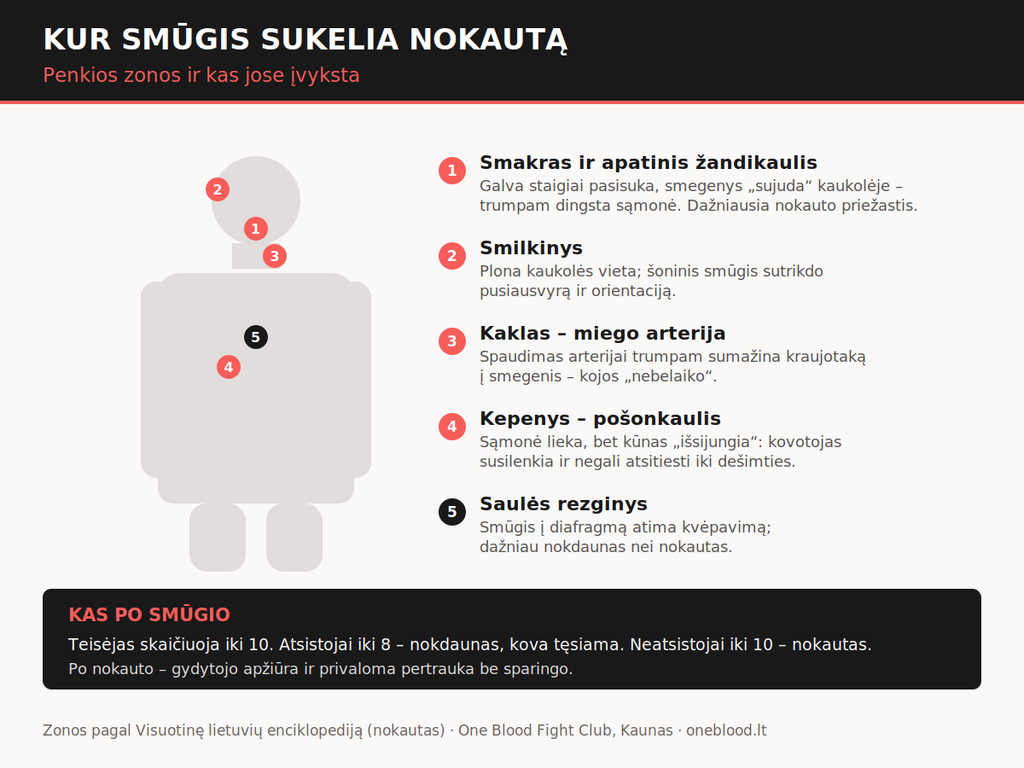 Infografas su žmogaus siluetu, išvadintos visos vietos žmogaus kūno srityje kur smūgiuojant galima padaryti nokautą.